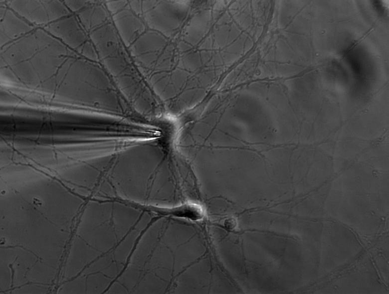 Fig_2_Neuron_with_a_patch_pipette