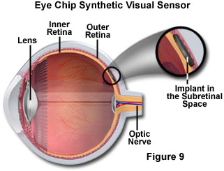 human vision figure9